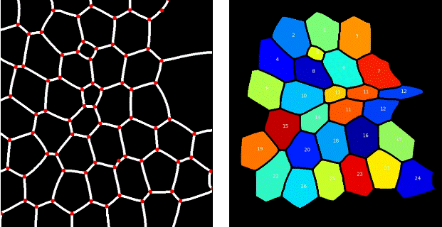 Active Foam Networks